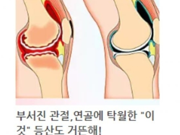 블루아카 겜창부 쌍둥이 수영복 I자 챌린지 유머 게시판