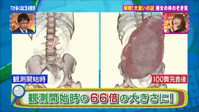 대식가의 메커니즘 규명.jpg_43.jpg