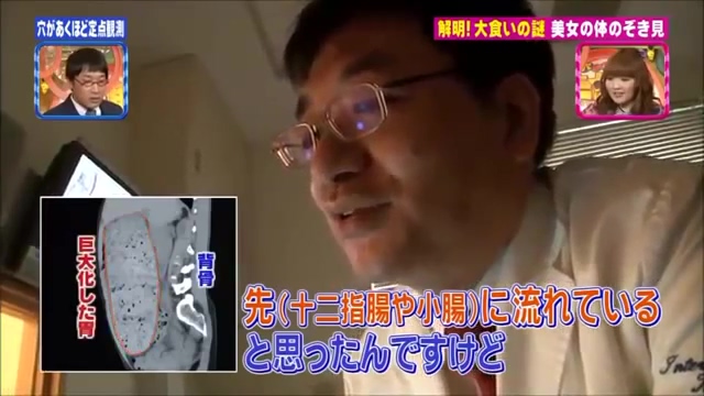 대식가의 메커니즘 규명.jpg_45.jpg