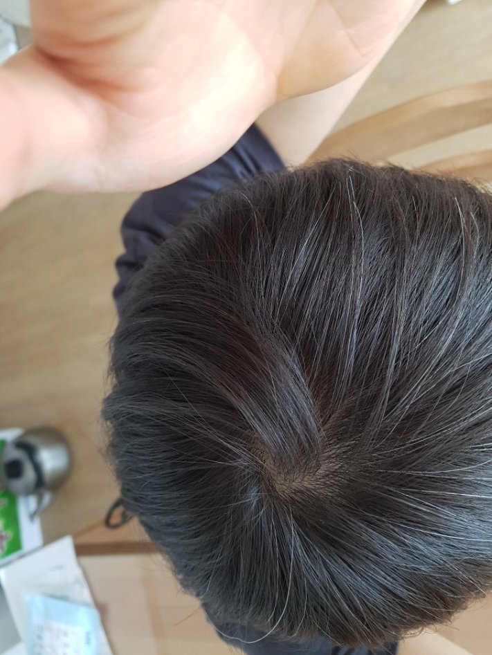 금딸 4일차 빠지는 머리가 급격히 줄어들었다_1.jpg