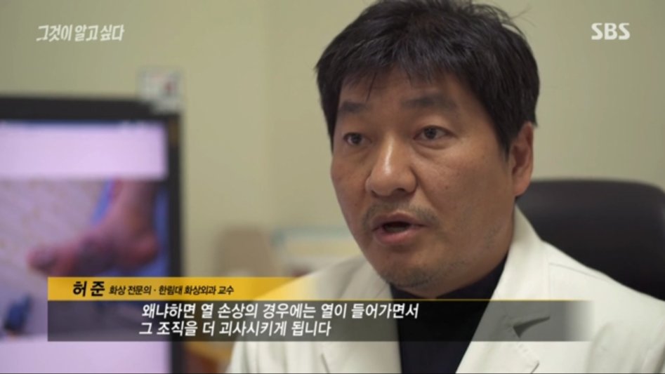 안아키식 화상 치료법_19.png