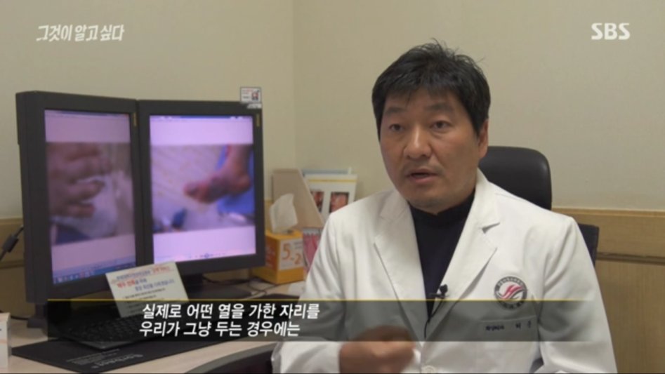 안아키식 화상 치료법_20.png