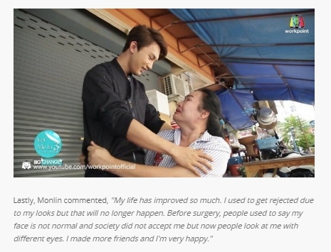 성형수술의 위엄_3.jpg