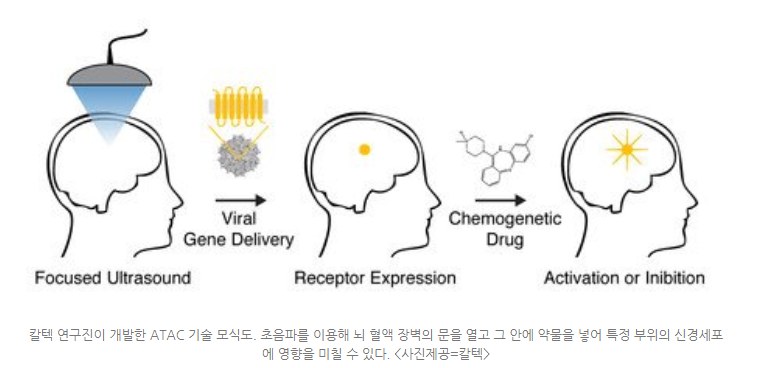 맨인블랙 기억제거가 곧 실현화 될지도 모름_2.png