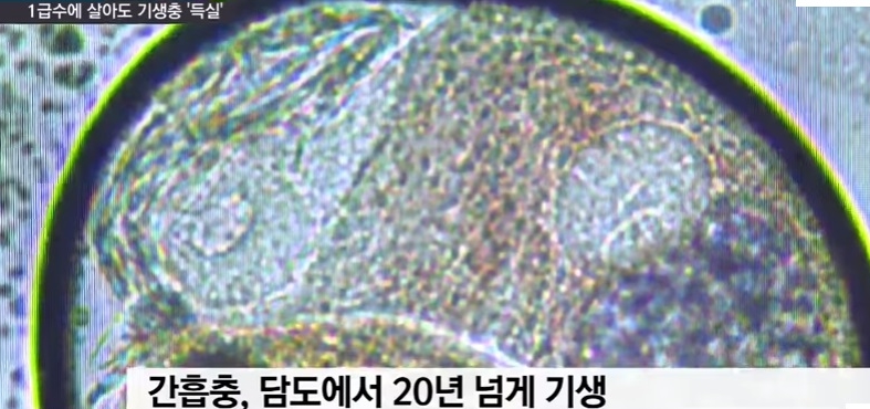 [혐주의] 1급수에 사는 민물고기라도 기생충 천지._8.jpg