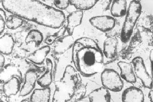 Clostridium.jpg