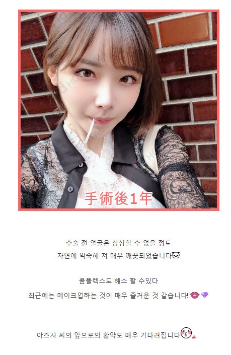 한국 성형외과에서 수술받은 AV배우_8.jpg