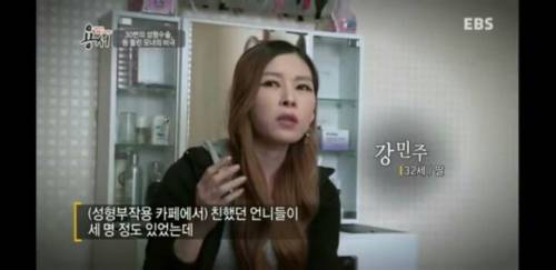 성형 수술을 쉽게 생각해서는 안되는 이유_1.jpg