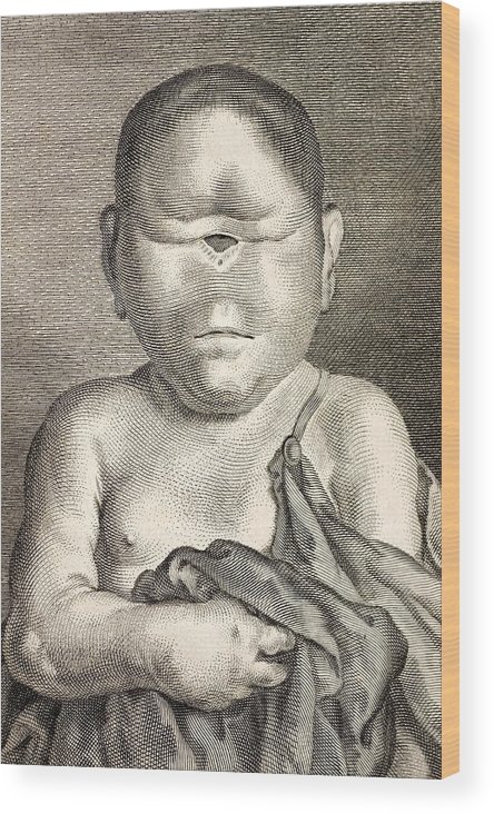 1777-buffon-cyclopia-congenital-disorder-paul-d-stewart.jpg