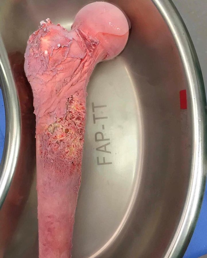 혐) 현대의학의 힘이란 대단해!_1.jpeg