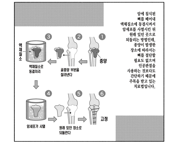 혐) 현대의학의 힘이란 대단해!_2.jpeg