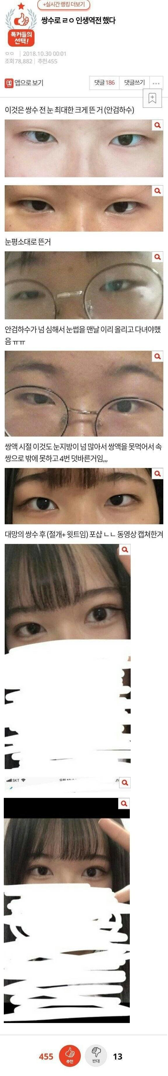 쌍수로 ㄹㅇ 인생역전 했다_1.png
