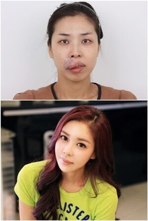 렛미인 의느님의 위엄 레전드_6.jpg