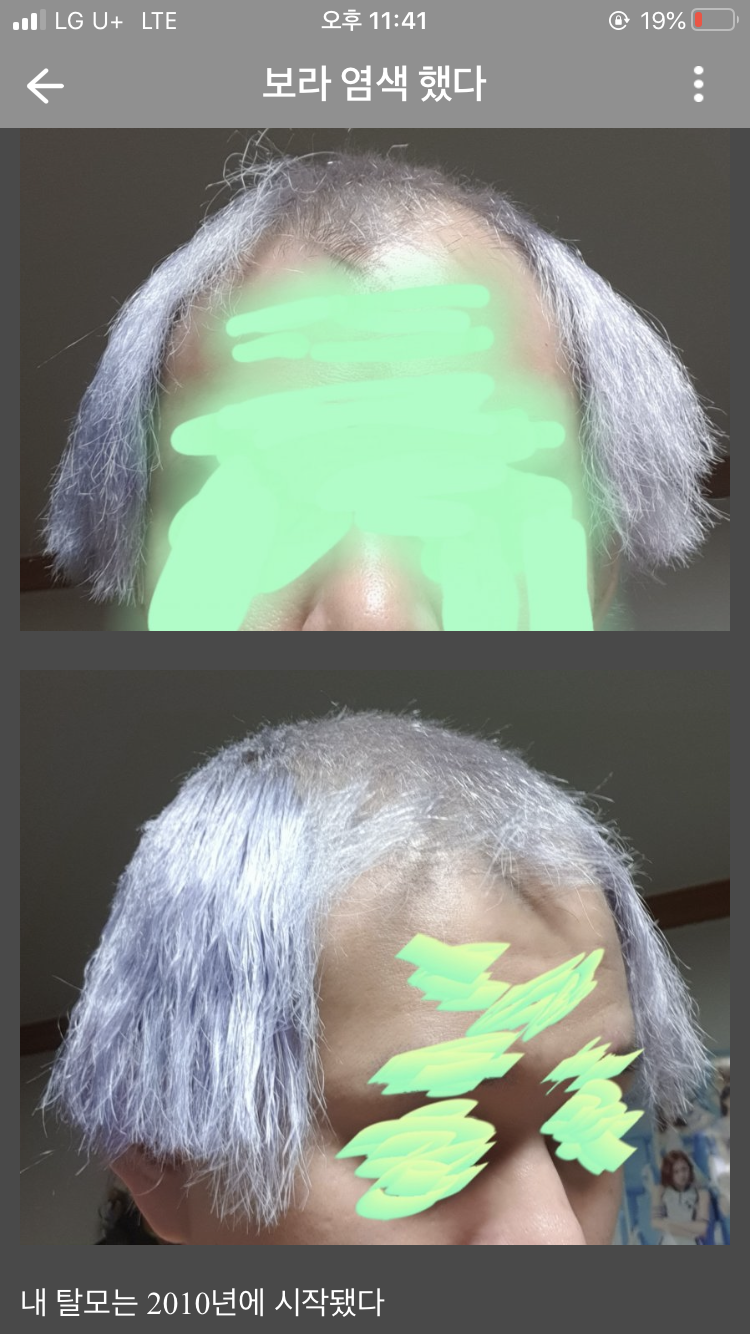 ë³´ë¼ìƒ‰ìœ¼ë¡œ ì—¼ìƒ‰í•œ ë
