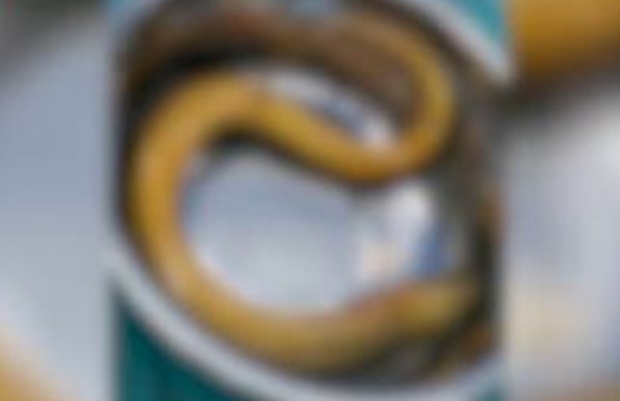 변비 고쳐보겠다고 20cm길이 장어를 산채로 항문에 쑥 넣은 남자_2.jpg