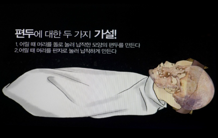 아기 머리 둥글게 만들려고 헬멧 씌우는 중국 부모들.news_2.jpeg
