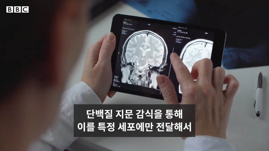 BBC) 코로나 백신과 신 암치료 방법_28.png