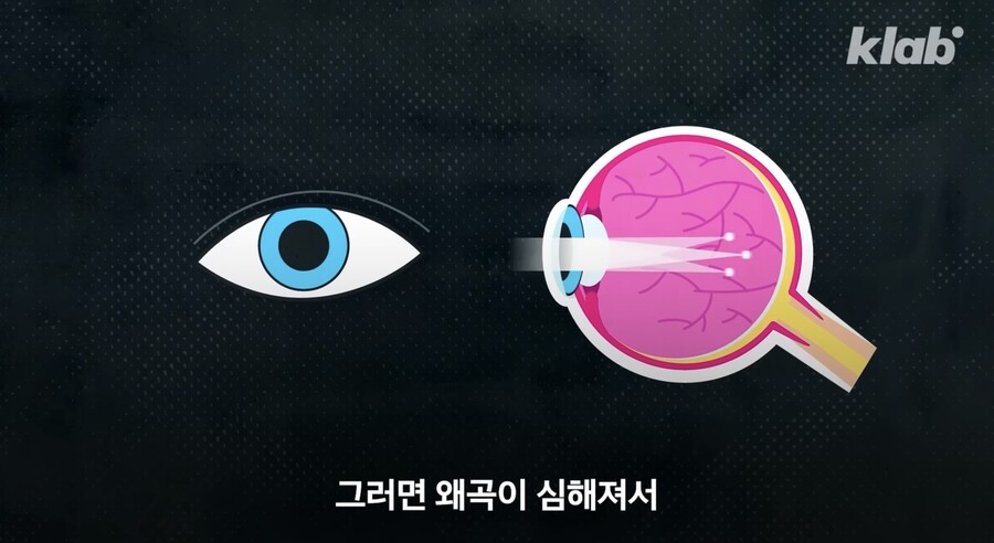 다크 모드 쓰면 눈 건강이 안 좋아진다?.jpg_22.jpeg