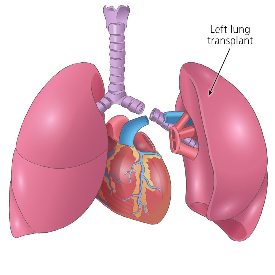 lungs-4.jpg