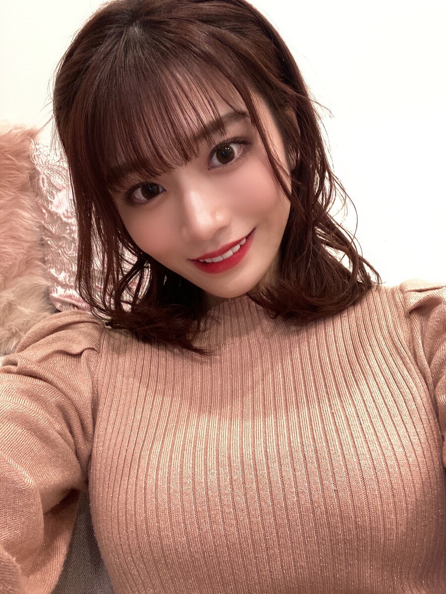 성형수술 잘 된 케이스 끝판왕 배우.PNG_1.jpg