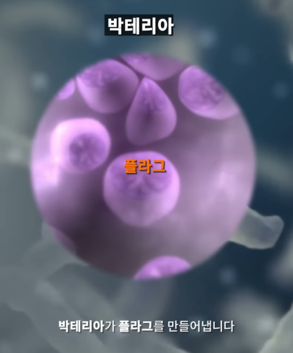 한달동안 이를 닦지 않으면 생기는 일_2.jpg
