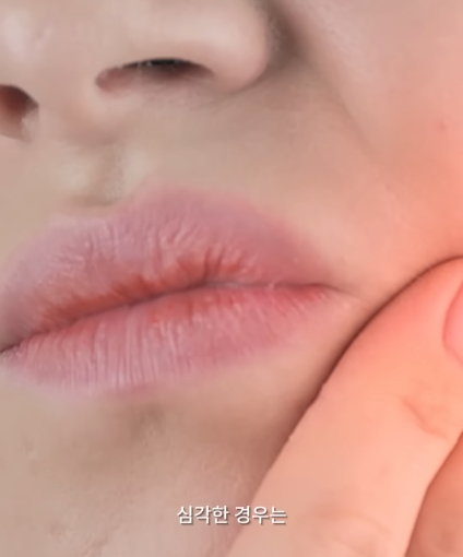 한달동안 이를 닦지 않으면 생기는 일_18.jpg