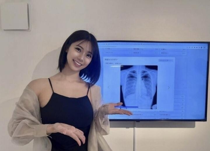 가슴성형 의혹에 시달려온 그라비아 아이돌 스즈키 후미나_5.jpg