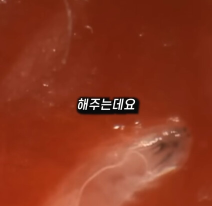 [혐] 딸기에 있는 하얀 털의 비밀_27.png