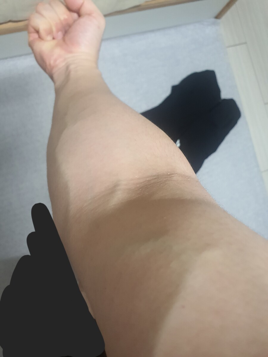 인증주의 팔에 이렇게 핏줄 서있는거 괜찮은거임