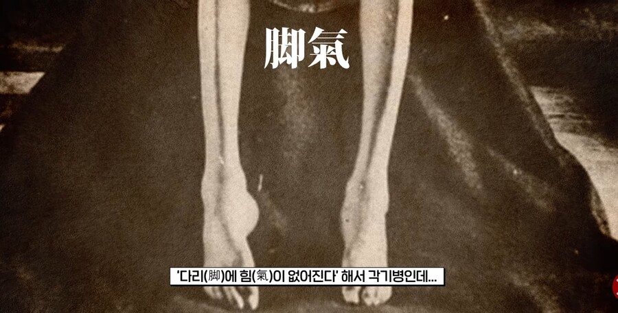 유독 일본 에도시대에 발생했다는 풍토병.jpg_13.jpg