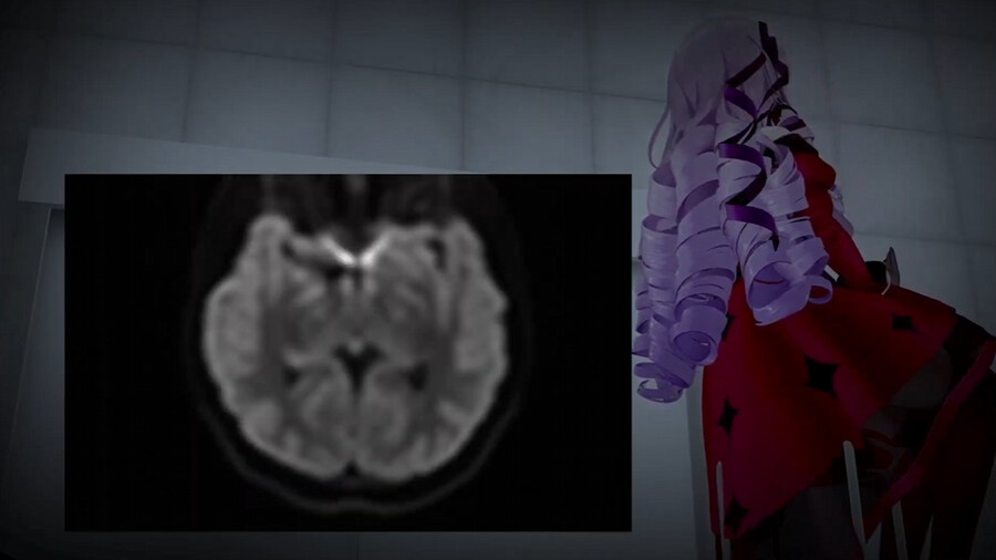 버튜버) 위 내시경 살로메는 잊어라!_3.png