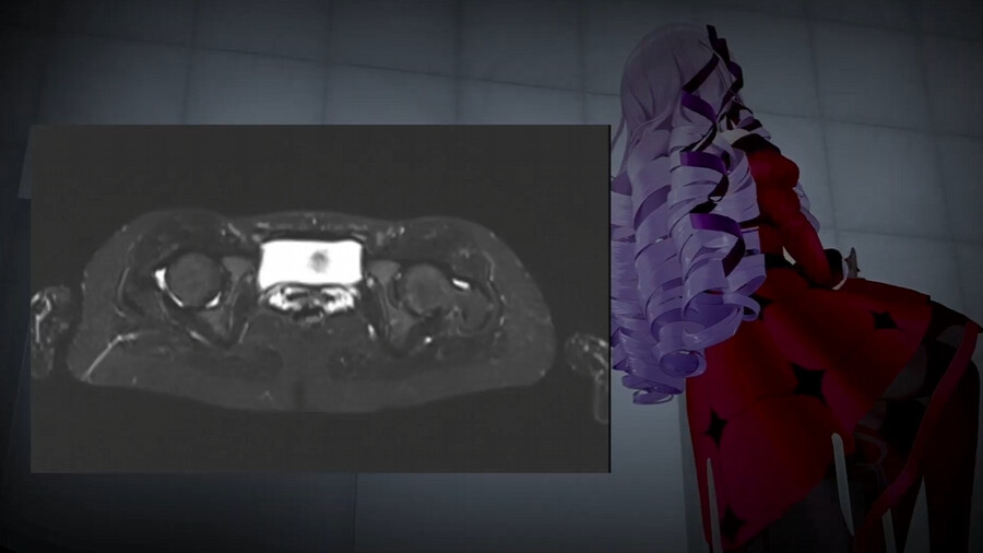 버튜버) 위 내시경 살로메는 잊어라!_4.png