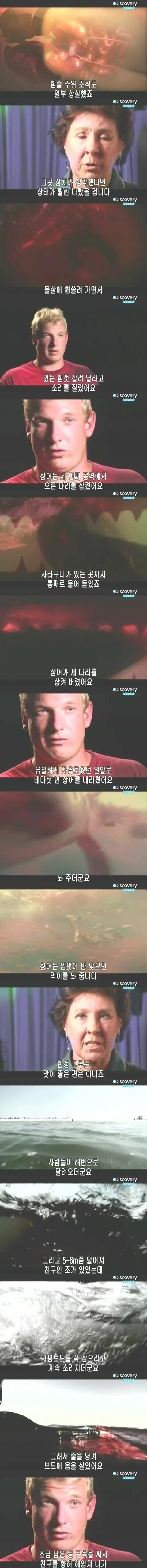 [극혐] 상어한테 물린 사람.jpg_5.jpg