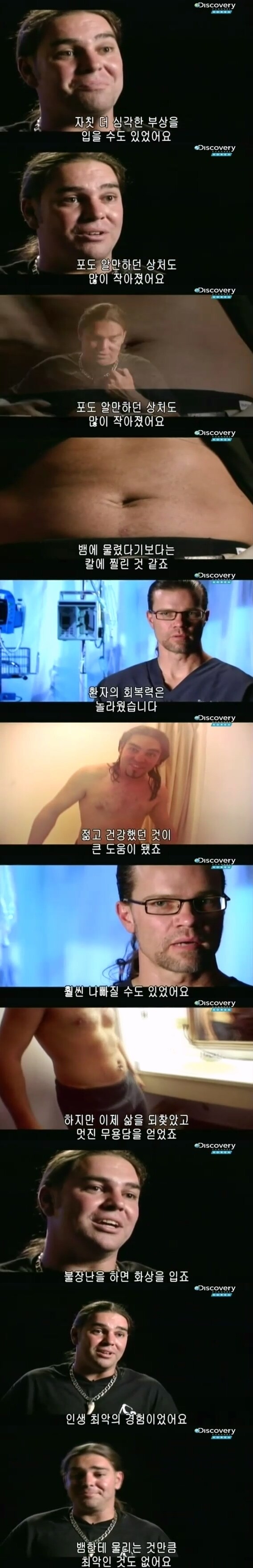 [극혐] 코브라한테 물려서 몸에 구멍이 생긴 남자.jpg_11.jpg