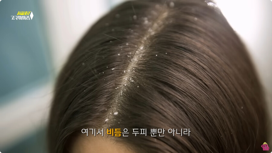 [스압] 한달 동안 머리를 감지 않으면 생기는 일.jpg_25.jpg