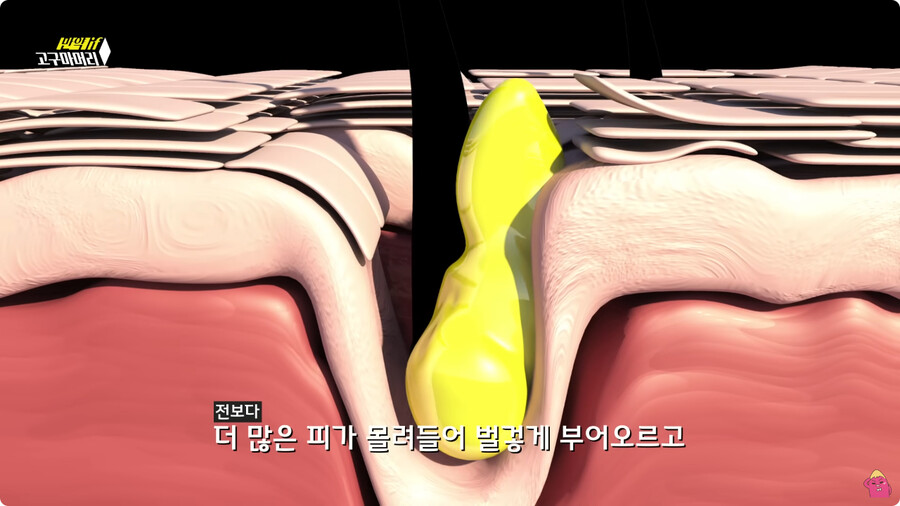 [스압] 한달 동안 머리를 감지 않으면 생기는 일.jpg_48.jpg