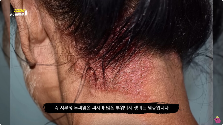 [스압] 한달 동안 머리를 감지 않으면 생기는 일.jpg_51.jpg