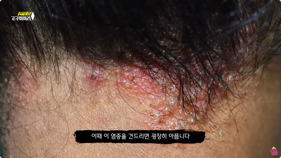 [스압] 한달 동안 머리를 감지 않으면 생기는 일.jpg_68.jpg
