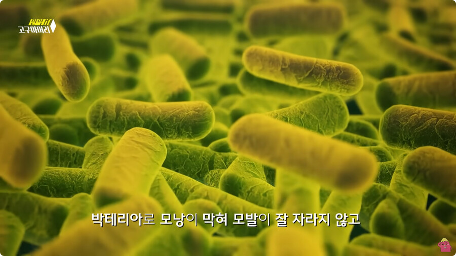 [스압] 한달 동안 머리를 감지 않으면 생기는 일.jpg_72.jpg