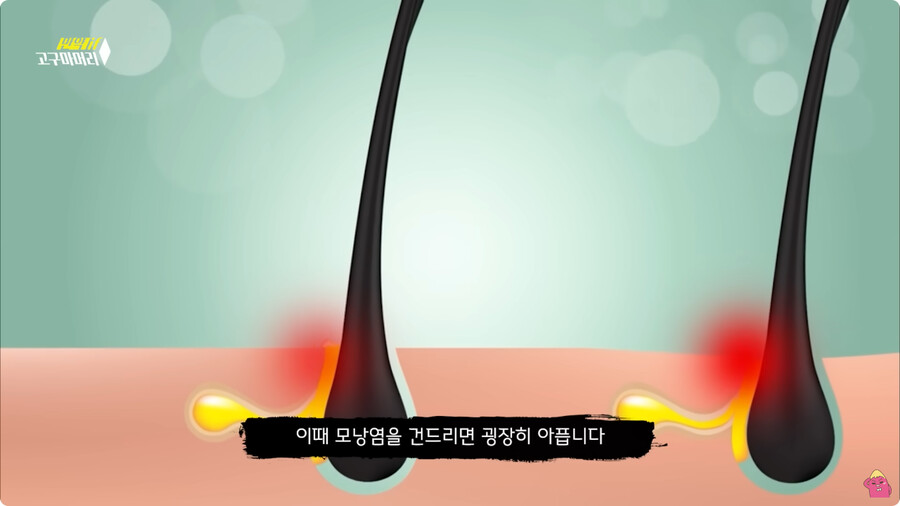 [스압] 한달 동안 머리를 감지 않으면 생기는 일.jpg_95.png