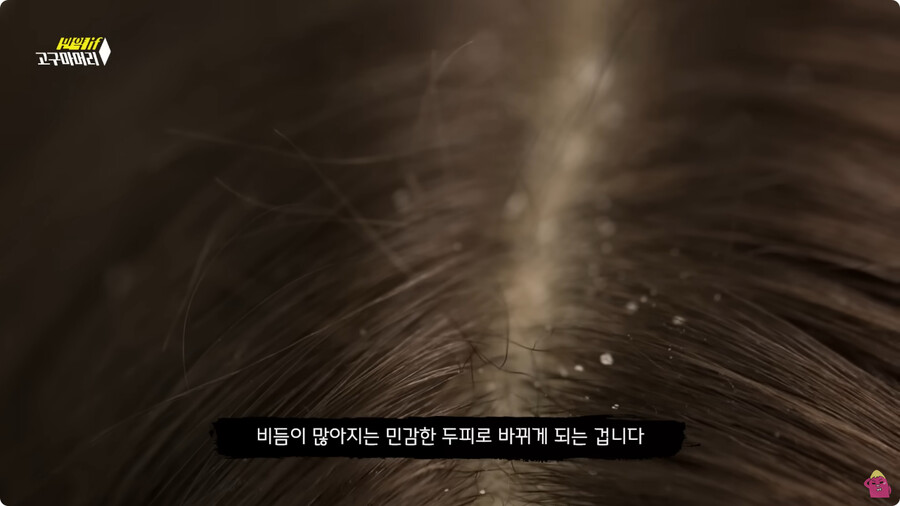[스압] 한달 동안 머리를 감지 않으면 생기는 일.jpg_108.jpg