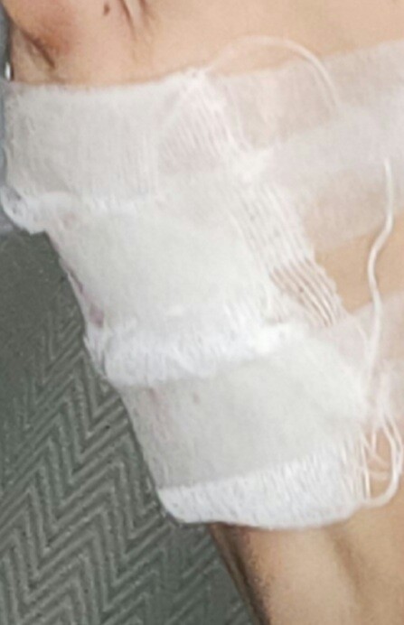 냥이)의 흉포함에 피를 봐따 (약혐)_2.jpg