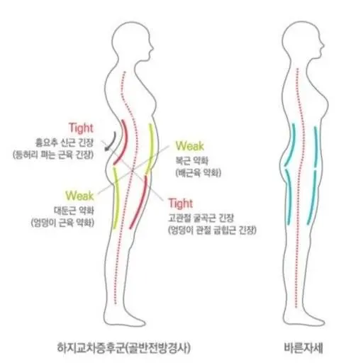 개인)박살난 코어_1.webp