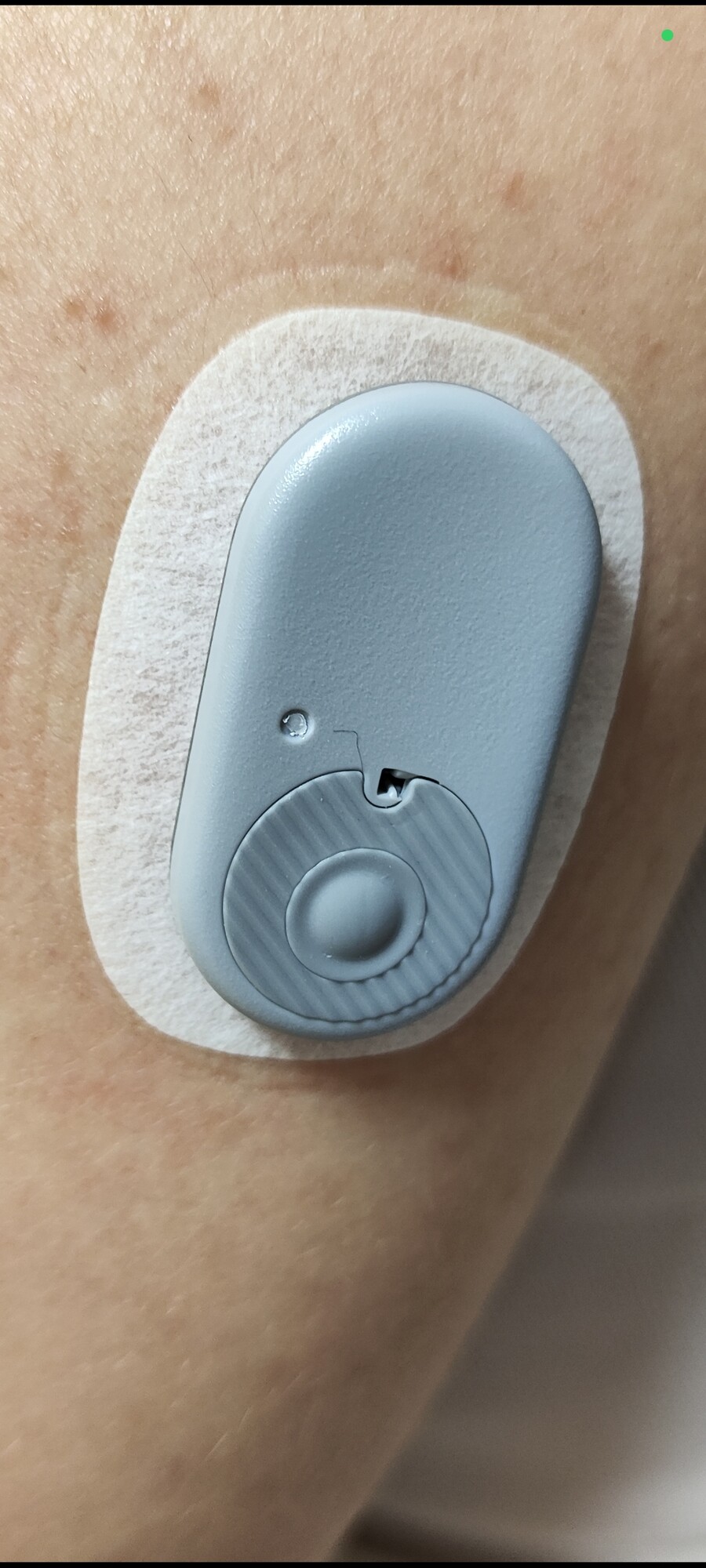 [사용기]연속 혈당 측정기 팔에 붙여봄._3.jpg