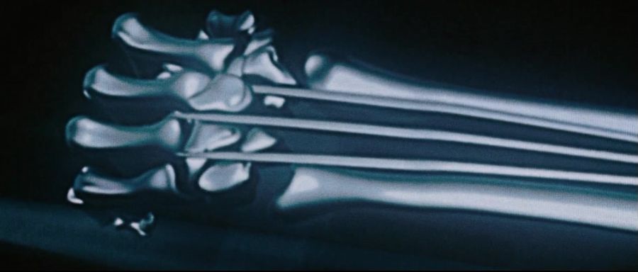 [엑스맨]클로를 뽑을때마다 고통이 밀려오는 울버린_1.jpg