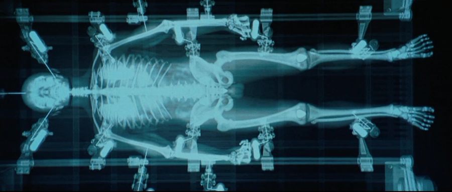 [엑스맨]아다만티움을 이식받는 울버린_5.jpg