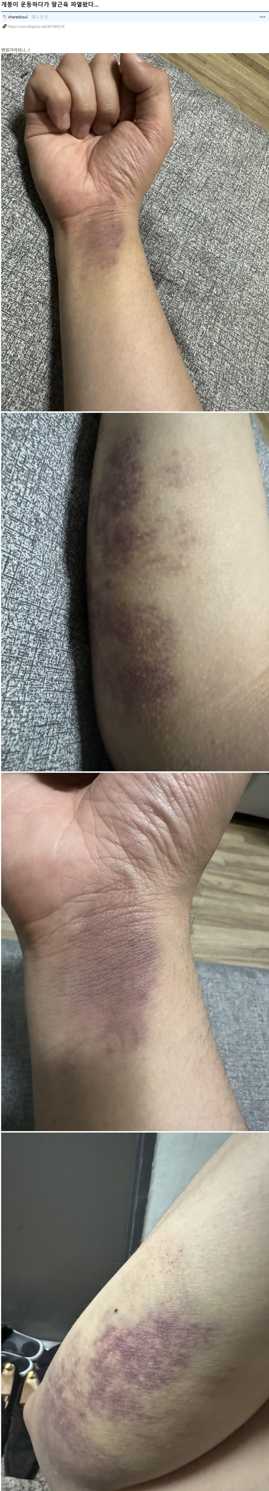 병원 가야 되나...?_1.jpg