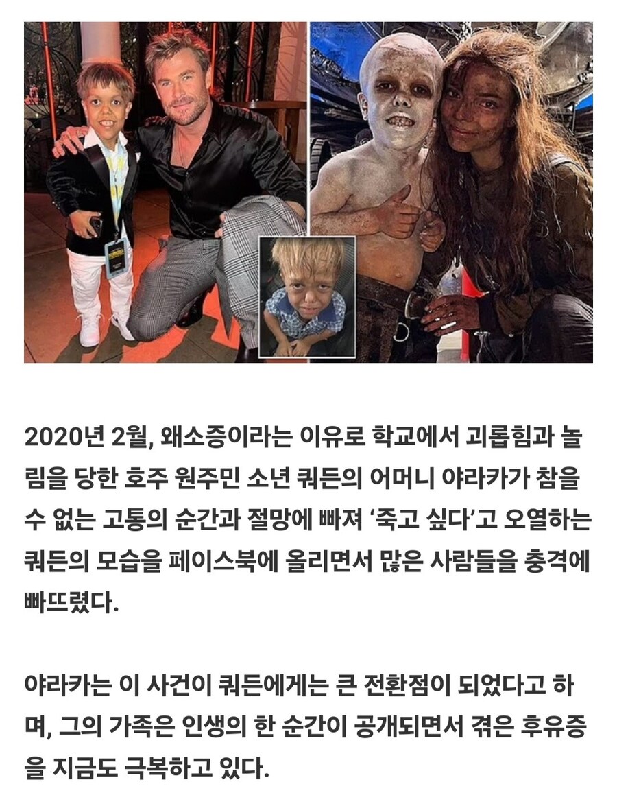 영화 '퓨리오사'의 왜소증 워보이_1.jpg