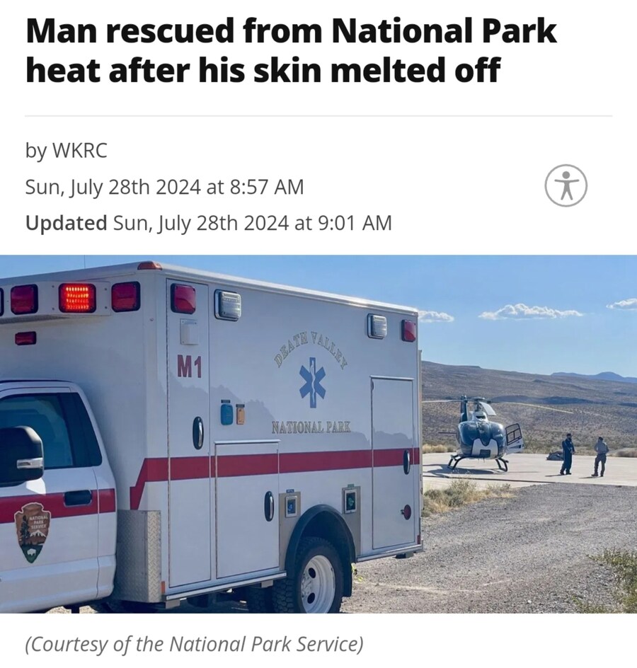 [공포] 미국 국립공원에서 피부 녹아내린 남자 구조.jpg_1.jpg