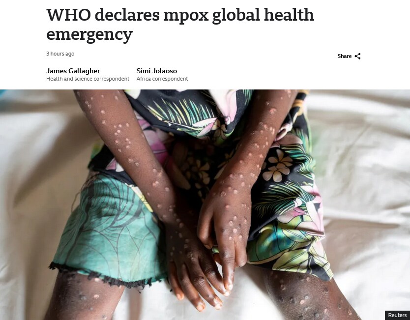WHO 근황 "원숭이두창 국제 비상사태 선포"_1.png
